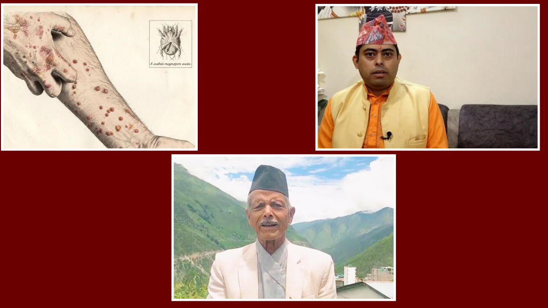 post-thumb